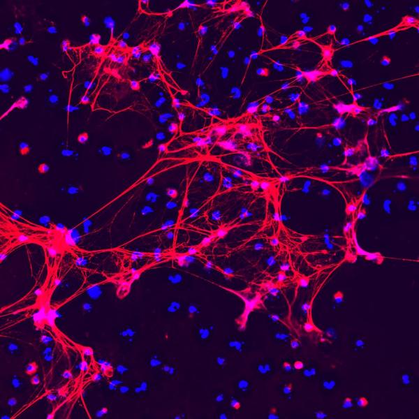 neutrophil extracellular traps (NETs)