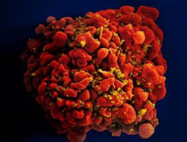 an HIV-infected T cell