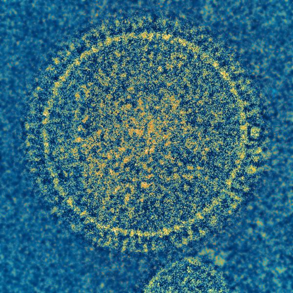 respiratory syncytial virus (RSV)