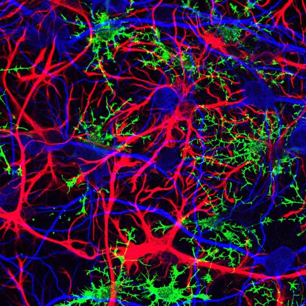 star-shaped brain cells called astrocytes (red)