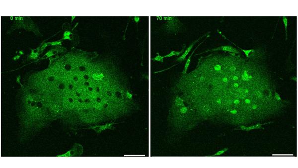 green fluorescent protein