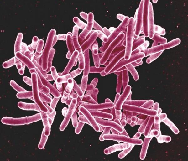 tuberculosis bacteria