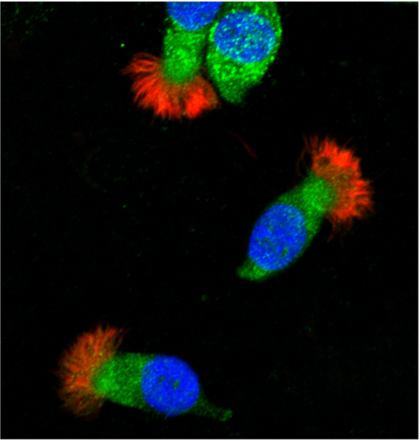 LDL receptors