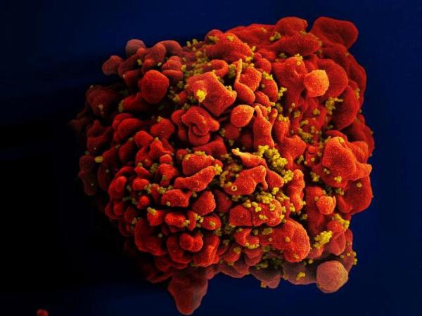 T cell (red) infected with HIV (yellow)
