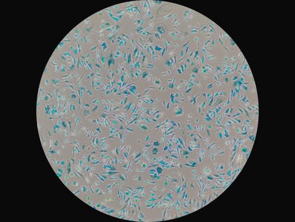 Microscopic image of senescent cells dyed in blue.