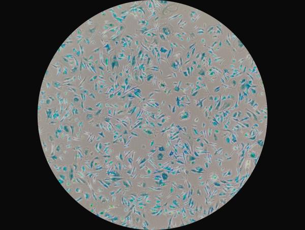 Microscopic image of senescent cells dyed in blue.