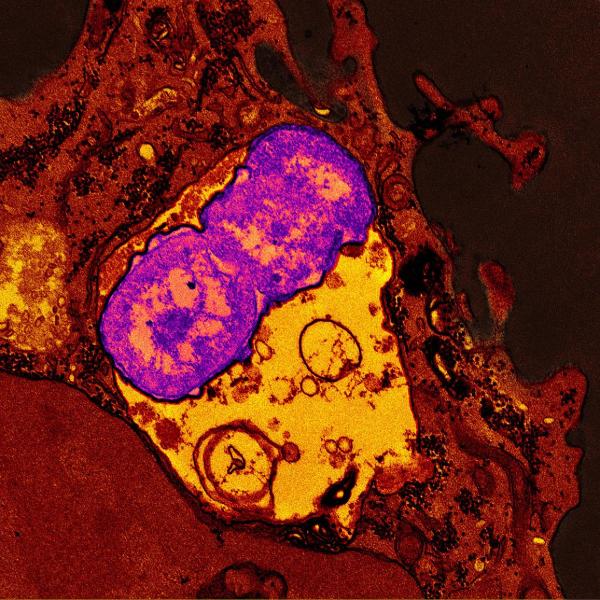 yellow and purple microscopy image of a bacterium