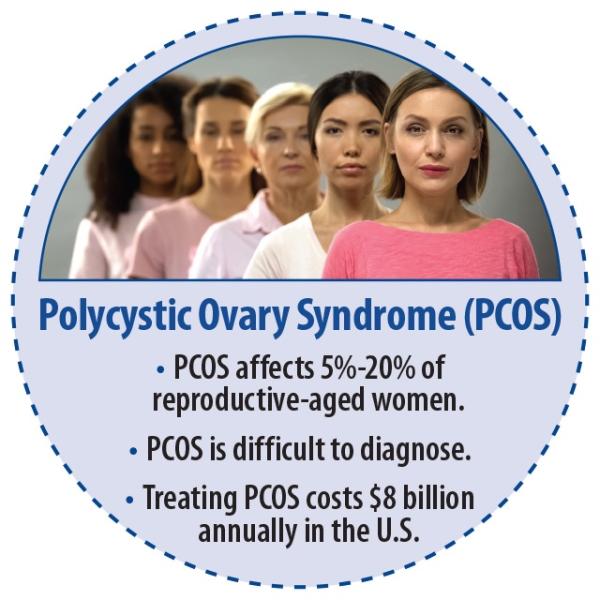 graphic explaining polycystic ovary syndrome