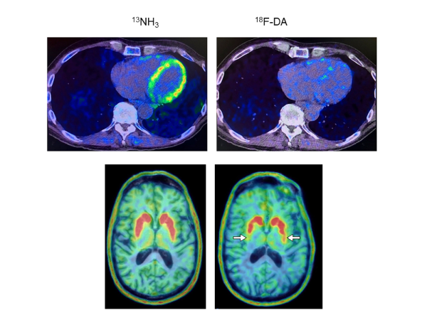 PET scans of the heart and brain in purple and green colors