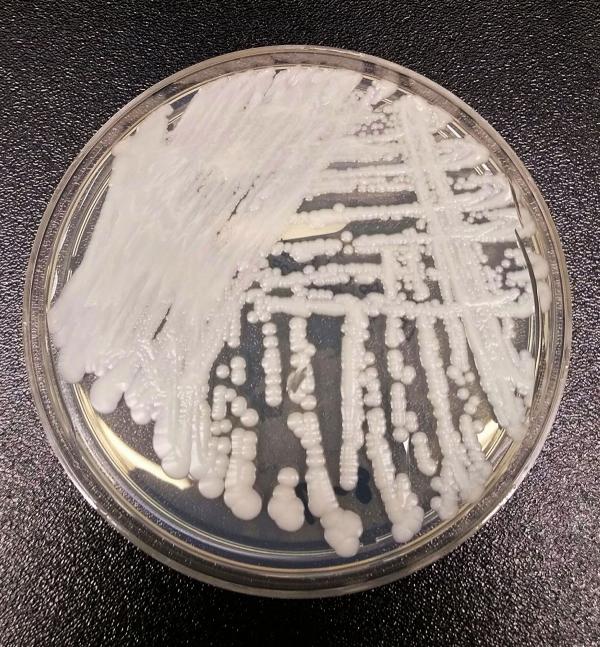 Candida auris fungus growing in a petri dish