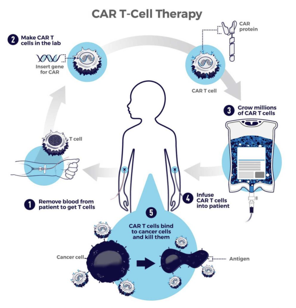 diagram showing how CAR-T cell therapy works