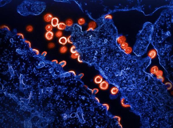 glowing reddish orange cells surrounded by deep blue cells