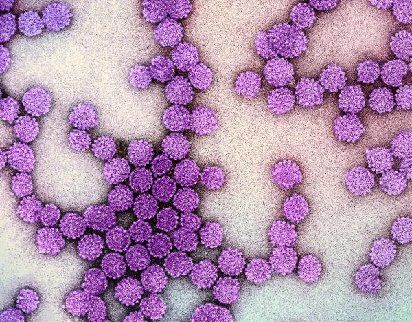 virus particles looking like clustered purple spheres