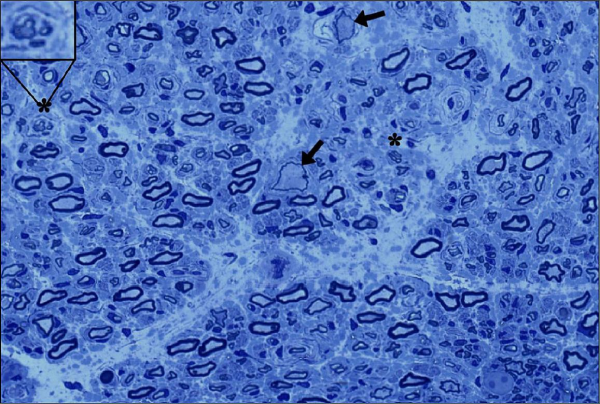 small blue ovals and light blue neurons in a branching pattern