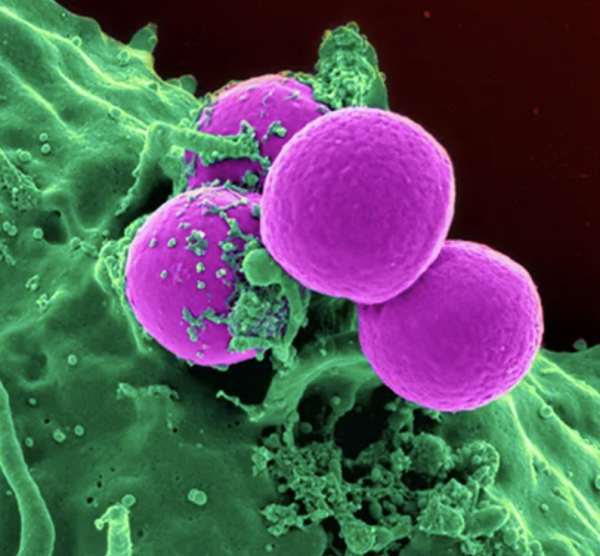 neutrophil (green) consuming bacteria (purple)