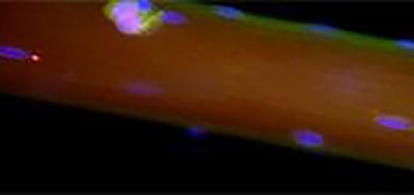 image of a muscle fiber showing a stem cell (pink)