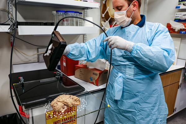 HBCC staff members takes a 3D scan of a donated brain
