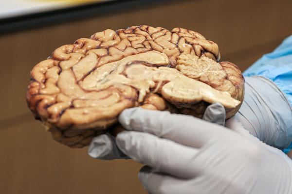 gloved hands holding a brain