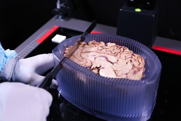 HBCC staff member using a 3D-printed mold to slice a brain into sections