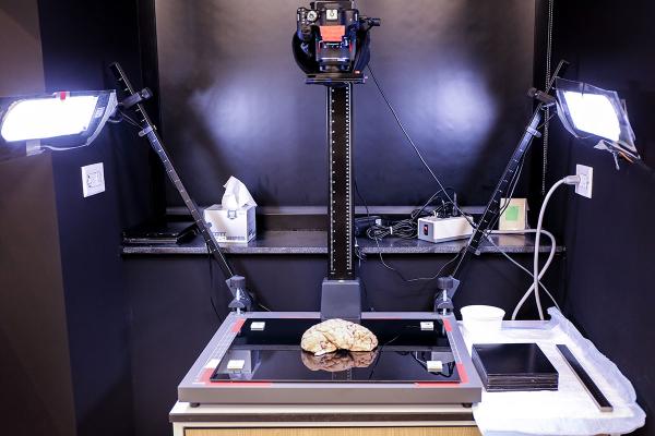 brain on an apparatus to take photos of it