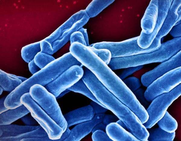 tuberculosis bacteria