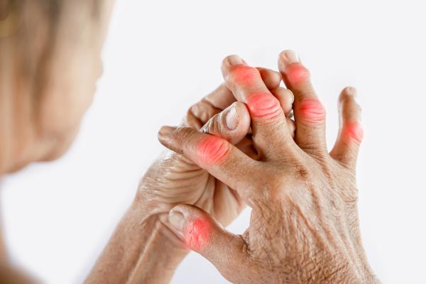 person with arthritis in their fingers