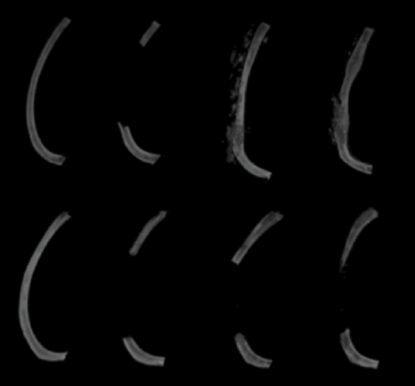 image of rib healing over time (left to right) in younger mice (top row) compared to older mice (bottom row)