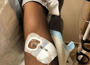 A healthy volunteer receives an IV infusion of an experimental Ebola therapy