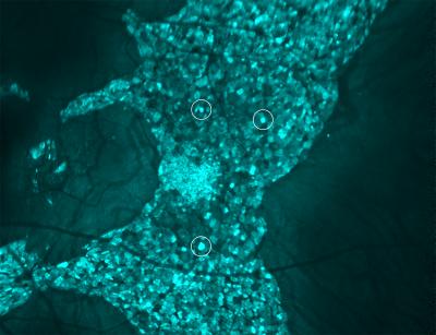 Retinal pigment epithelium cells