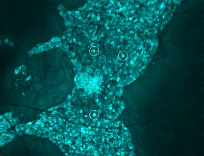 Retinal pigment epithelium cells 