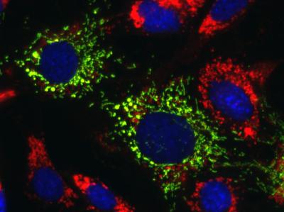Lipid-filled lysosomes