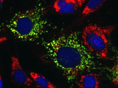 Lipid-filled lysosomes 