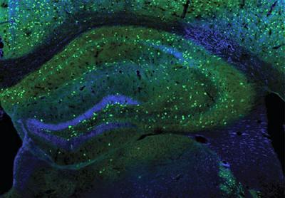 green Interneurons in a brain’s hippocampus