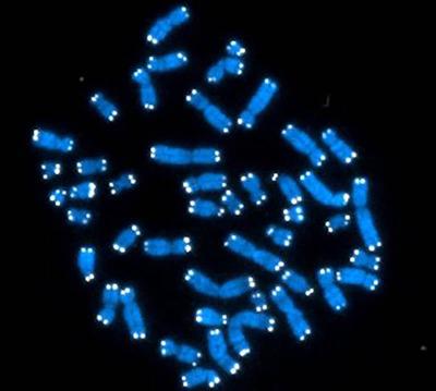 human chromosomes (blue) capped with telomeres (white)