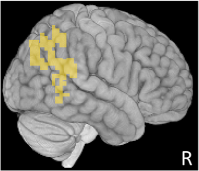 image of a brain with yellow shading over studied regions