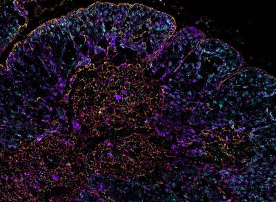 purple orange and violet imaging scan of human thymus